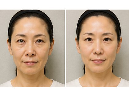 コンビンス(convince)の写真