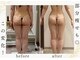 ナチュールファースト(naturel first)の写真/【部分だけケアしたい方！】隠してた部分、出せる身体へ。
気になるヒップと脚の脂肪を集中撃退！