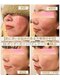 ホイ(Hui)の写真/【優しく軽いタッチで驚きの改善率】敏感肌や繰り返す赤み系の肌荒れに◆Dr.ボッダー式リンパドレナージMLD