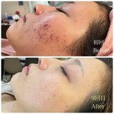 デュクレ(Beauty Clinic Ducle)