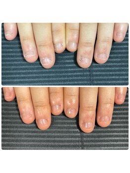 ウェルズユキ(well's yuki)/爪の上が広がる 貝爪