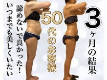 サロン ド ボーテ ラーンジュ 岐阜店(salon de beaut'e L'ange)/ハイパ-ナイフEX2ダイエット痩身