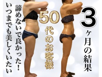 サロン ド ボーテ ラーンジュ 岐阜店(salon de beaut'e L'ange)/ハイパ-ナイフEX2ダイエット痩身