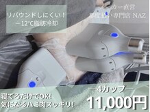 ナーズ(NAZ)の雰囲気（【人気急上昇】冷却痩身4カップ！肌管理と併用可能です♪）