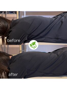 カイロプラクティック ネクサス/猫背とそり腰を撃退☆