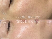 ベルード(veludo)/