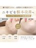 2回来店★【繰り返すニキビ】肌質改善ハーブピーリング+赤み軽減鎮静パック