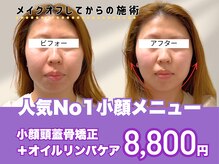 ミンティー 三宮店の雰囲気（小顔頭蓋骨矯正/たるみ・むくみ・歪み・エラ張り・ほうれい線）