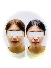 ワカヤマ 小顔(Wakayama)/★Before・After★