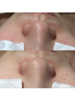 ファウンデーション(FOUNDATION)/毛穴きれい!トーンアップ