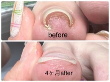 コム(Com)の雰囲気（巻爪矯正もお任せ下さい）
