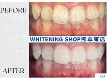 ホワイトニングショップ熊本東店/ホワイトニングショップ熊本東店