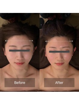 グレースフィオーレ 豊田店(gracefiore)/ビフォーアフター