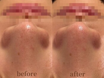 サロン エム(saron M)/お客様ビフォーアフター