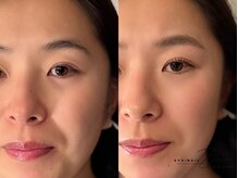 ダイム 仙台店(DIME)/セットメニューで垢抜け