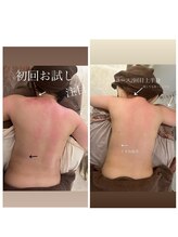 フェリシテ(FELICITE)/浮腫み・セル脂肪撃退