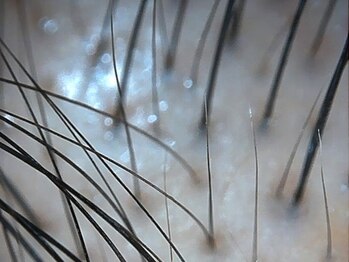 ボディデザインホームクレアフェリーチェ 神戸(Body design home Crea felice)/MOUMITUスカルプ/毛密エステ