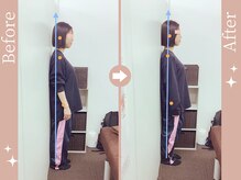 骨盤メディカル整体院 福岡天神院の雰囲気（メディア話題！モデルアスリートも通う姿勢骨盤の専門☆福岡整体）