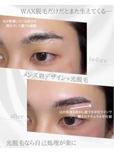 リノア(Linoa)/メンズ眉毛ビフォーアフター