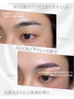 リノア(Linoa)/メンズ眉毛ビフォーアフター