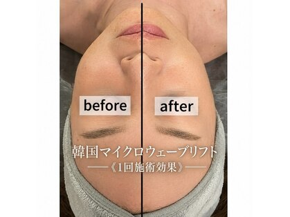 ディア(Deer)の写真