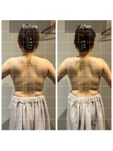 ロッタ エクリュ(Lotta ecru+)/筋膜リリースマッサージ