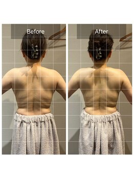 ロッタ エクリュ(Lotta ecru+)/筋膜リリースマッサージ