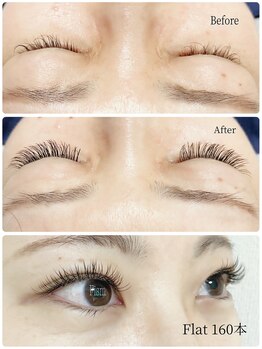 フィズム (Fism)/【フラットマット】160本