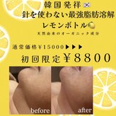 エステサロン ジュエル 高松レインボー店(JEWEL)