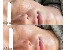 アイティス(Salon Its)/【Before &After】