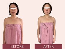 アンリール(Anrire)/【板橋/フェイシャルエステ】