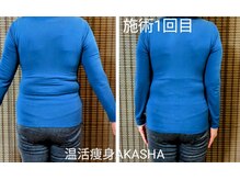 ヨサパーク アカーシャ(YOSA PARK AKASHA)/後ろ姿の気になる段々