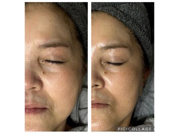 フレア(FULEA)/ラミネーションピール