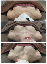 ロココ 豊田店(Rococo)/ビフォーアフター