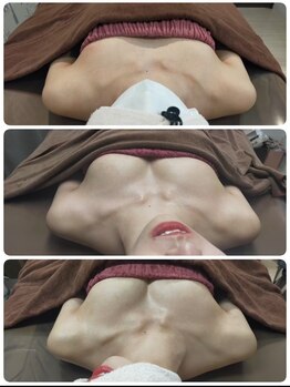 ロココ 豊田店(Rococo)/ビフォーアフター