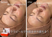 コンフィデンス(Confidence)