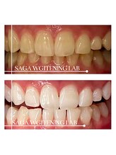 佐賀ホワイトニングラボ/