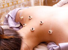 まゆ鍼灸院 岸和田 和泉/ほっこりお灸でつらさ緩解