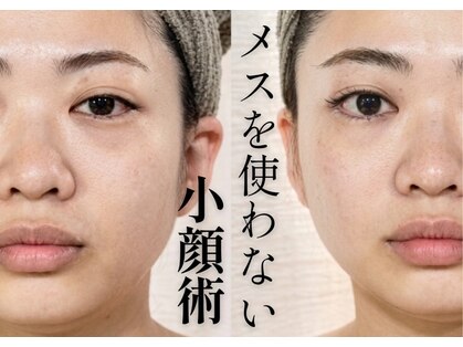 シェノン(Chainon)の写真