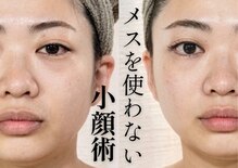 シェノン(Chainon)