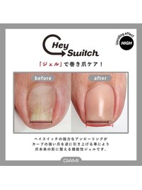 最先端【トラブル爪緩和ケア 】