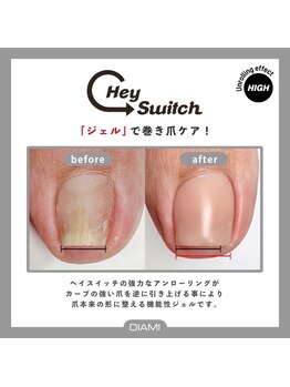 アルテミス(ARTEMIS)/最先端【トラブル爪緩和ケア 】