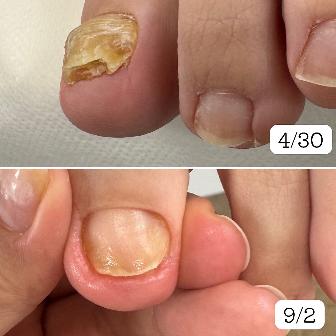 徳島駅で足裏角質除去・角質ケアが人気のネイルサロン｜ホットペッパー