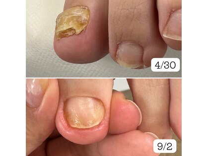 なかやまネイルクリニックの写真