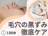 人気No.1艶肌毛穴ケア。毛穴洗浄×ララピール《黒ずみ・開き徹底ケアコース》