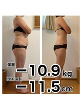 ラクエ/ビフォーアフター