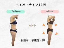 美容整体ウェリナ 中川八田院/小顔矯正/骨盤矯正/痩身整体