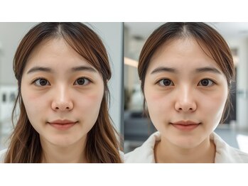 えがお鍼灸整骨院 栗東院/日々のパソコン業務での眼精疲労