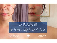 シンシア(sincere)/続けていくことで更に効果アップ