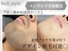 【特別価格】青髭さよなら◎ 毎日の自己処理卒業【メンズ脱毛】ヒゲ全体脱毛
